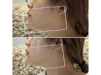 スリーアイ 天王寺店(3EYE)/REDSHOTビフォーアフター