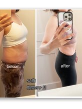 24ダイヤモンドジム 住吉店(24 DIAMOND GYM)/before/after