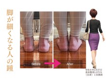 ロータス(LOTUS)/美脚ラインに整える骨格ケア