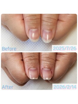 スペシャルハンドケア