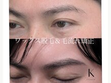 ケイ(K)