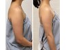 【本気で二の腕ケア】振袖肉撃退！脂肪・むくみ徹底ケア