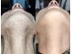 エデン 守谷店(EDEN)の写真/★OPEN限定★大人気＆当店自慢の髭脱毛【ヒゲ脱毛￥500/学割￥100】短パンも自信がもてる脚脱毛2500円！