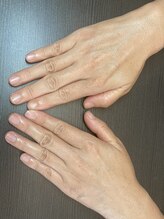 桃の木 吉祥寺店/40代ネイルケアafter 