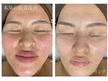 ビューティサロン アール(R)の雰囲気（一回の施術でこの仕上がり！艶肌へ♪）