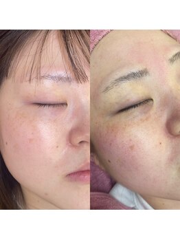 アイ クイーン 押上店(Eye queen)/