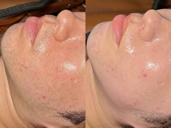 ルーナジェーナ(Luna llena)/池袋 エステ ルーナジェーナ