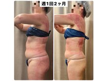 スピード美人 銀座店の雰囲気（食事制限なし！運動なし！痛みあり！★痩身スライドカッピング）