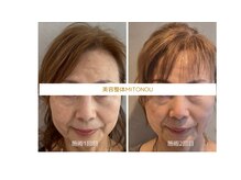 ミトノウ(MITONOU)/お客様ビフォーアフター