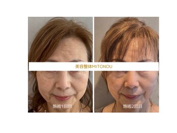 ミトノウ(MITONOU)/お客様ビフォーアフター
