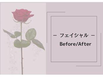 ヴィータローズディセ 名古屋本店(VITA ROSE Desse)/before→after