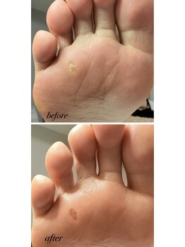 ラヴィ(La vie)/我慢しないで！