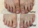 foot care