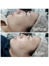 レン(Ren)/ゾンビマスク<小顔/ハリツヤ>