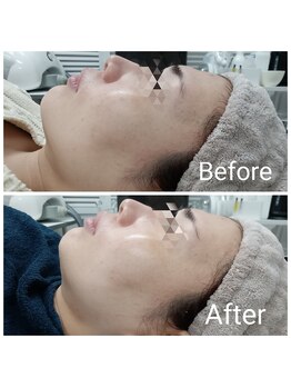 レン(Ren)/ゾンビマスク<小顔/ハリツヤ>