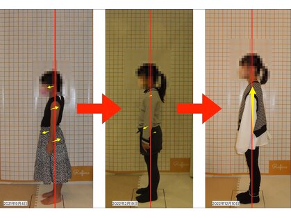 リファイン(Refine)の写真