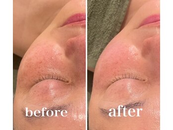 リム(Lim:)/リアボーテ◆タラソ