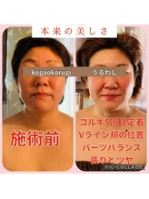 ウルワシ(Uruwashi)/★ビフォーアフター★