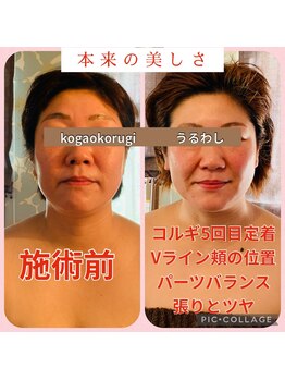 ウルワシ(Uruwashi)/★ビフォーアフター★