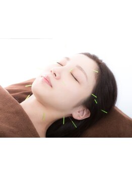 鍼灸施術を受けたい