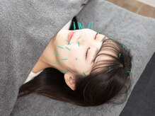 イニシオ 日本橋本院(inicio)の雰囲気（凄腕美容プロデューサー監修の美容鍼メニューも大人気です！）