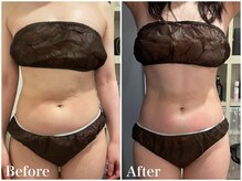 サロンドフェイス(Salon de Faith)/【ラジオ波】10回施術♪