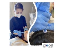 アベニール(AveniR)/プロセル頭皮トリートメント