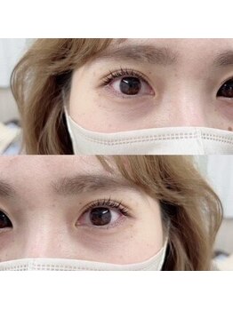 アイラッシュ ネイルサロン アレス 経堂店(Eyelash Nailsalon ales)の写真/違和感なく自然にボリューム＆目力UP！すっぴん顔にも自信が持てる見た目に変身♪初めての方も◎