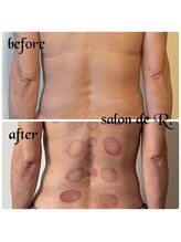 サロン ド アール(salon de R.)/【お背中骨氣・60代・施術効果】