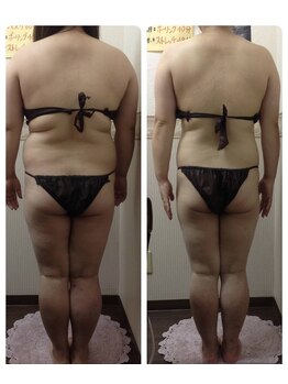 エステティックサロン ピュール ボーテ 東金店/ＢＳＰダイエット