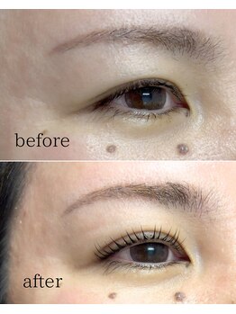 アモール 丸亀店(Amor)/眉毛/まつげパーマ/毛穴/脱毛