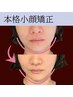 【初回限定♪小顔】整体院の本格小顔矯正30分　3980円
