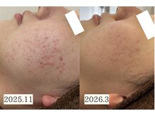 アエオボンヌール(A.E.O BONHEUR)の雰囲気（お肌の修復力を高めてトラブルのない肌を実現）