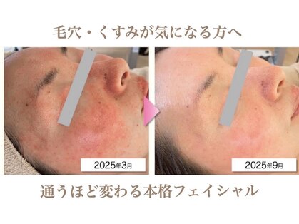 ウルオイ(uruoi)の写真