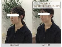 小顔×姿勢改善 KISHI BEAUTY SALON/【小顔矯正】