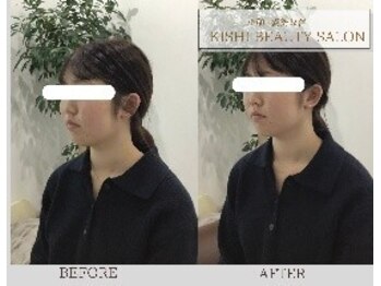 小顔×姿勢改善 KISHI BEAUTY SALON/【小顔矯正】