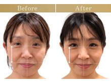 ドクターボディ 自由が丘店(Dr.Body)の雰囲気(【顔全体の歪み/口元・鼻の歪み/目の高さ/身体の歪み】自由が丘)