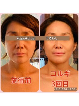 ウルワシ(Uruwashi)/★ビフォーアフター★