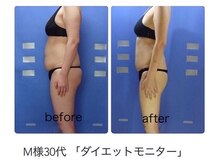 エステージ(estage)/