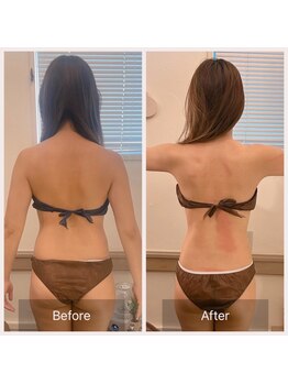 カルナ(carna)/《3か月計6回》2週間に1回