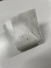 ラッシュ(RUSH)/初回施術だけで抜けたヒゲです！