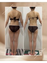 ビューティーサロン シンデレラ 心斎橋本店(Cinderella)/美しくやせたい方はコレ！