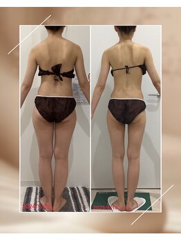 ビューティーサロン シンデレラ 心斎橋本店(Cinderella)/美しくやせたい方はコレ！