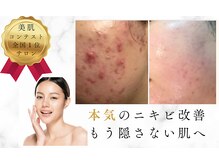 サロンドエクラ 南堀江(salon de eclat)