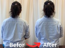 ナオル整体 札幌院(NAORU整体)/体の左右差/側湾/姿勢のズレ