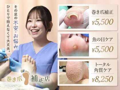 大宮巻き爪補正店の写真