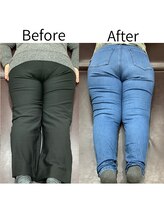 リセラ(Re:seraph)/Before After