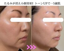 キラリ リラクゼーション(Kirary relaxation)