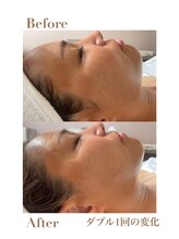 コモア(COMOA)/小顔になりたい方はCOMOAへ★