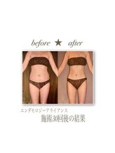 ベルア(Bellelea)/痩身エンダモロジーアライアンス